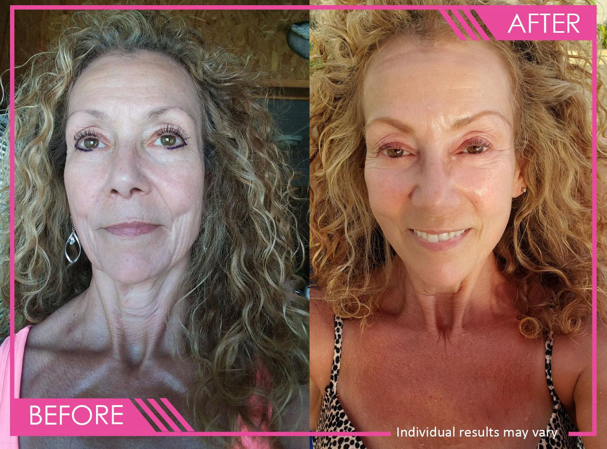 Super C Serum